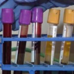blood samples